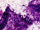 MOP IIb, detail na klíčové buňky (CC), zvětšeno digitálně 3000x